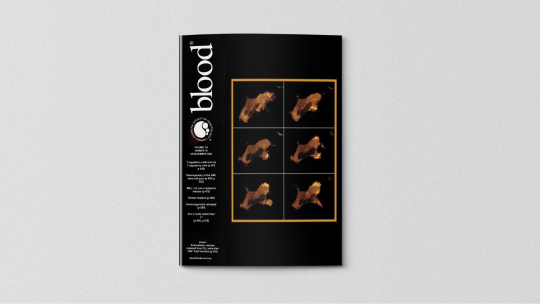 Preview of 'blood' Journal